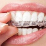 Invisible Aligners Cost in India: A Realistic Guide Before You Decide