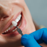 What to Expect When Visiting a Dental Implant Dentist in Sacramento for Long-Term Tooth Replacement Solutions