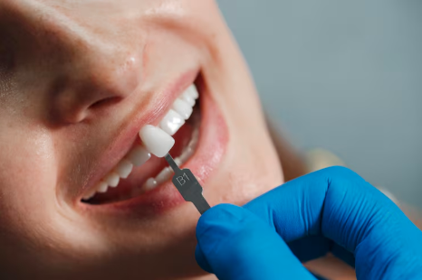 What to Expect When Visiting a Dental Implant Dentist in Sacramento for Long-Term Tooth Replacement Solutions