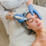 Why Patients Are Exploring Dermatologist Skin Lightening Treatment in North Miami for More Even-Toned Skin